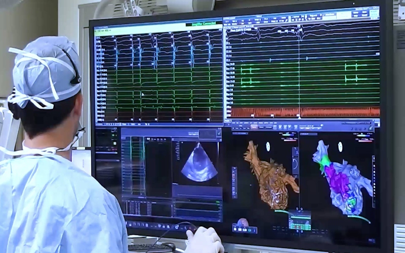 Catheter Ablation