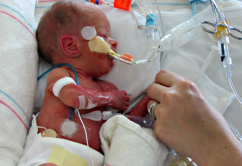 Infant Mortality