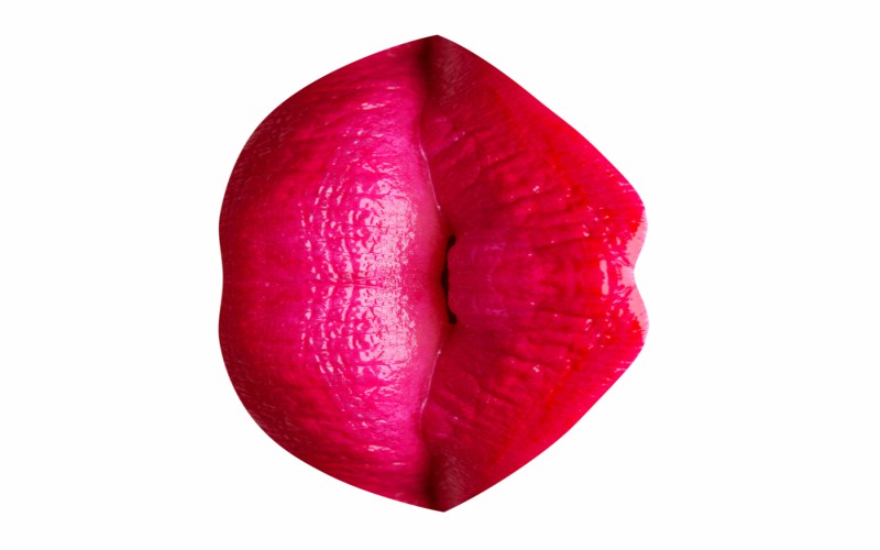 Labialplasty