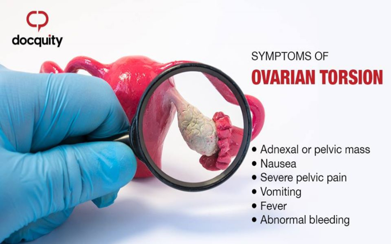 Ovarian Torsion